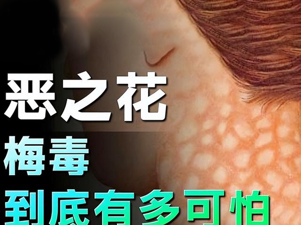 梅毒健康防护科普：认识、预防梅毒